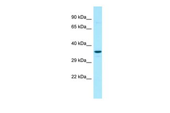 G6PC3 Rabbit Polyclonal Antibody