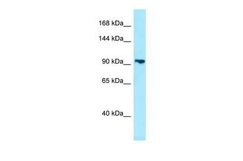 PDE8B Rabbit Polyclonal Antibody