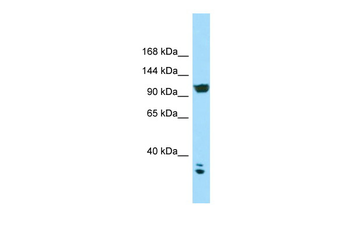 CACNA2D2 Rabbit Polyclonal Antibody