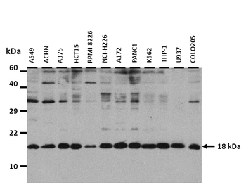 RFK Rabbit Polyclonal Antibody