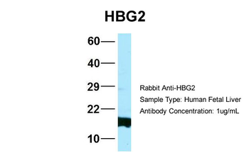 HBG2 Rabbit Polyclonal Antibody