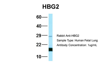 HBG2 Rabbit Polyclonal Antibody