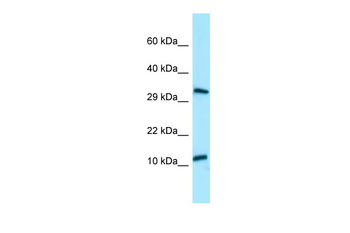 BPY2 Rabbit Polyclonal Antibody