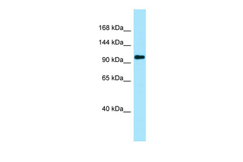 PKP4 Rabbit Polyclonal Antibody