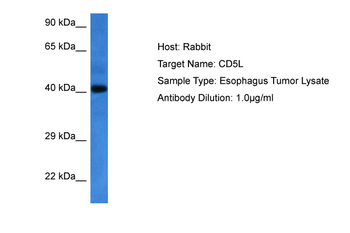 CD5L Rabbit Polyclonal Antibody