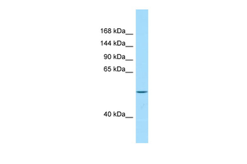 VPS13B Rabbit Polyclonal Antibody