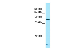 THADA Rabbit Polyclonal Antibody