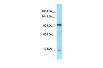 IPO7 Rabbit Polyclonal Antibody