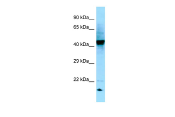 RGP1 Rabbit Polyclonal Antibody