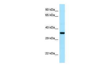 CAPZA1 Rabbit Polyclonal Antibody
