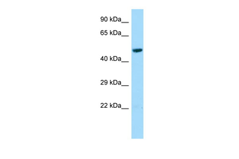 L2HGDH Rabbit Polyclonal Antibody