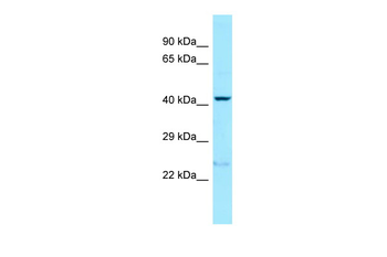 PRLHR Rabbit Polyclonal Antibody