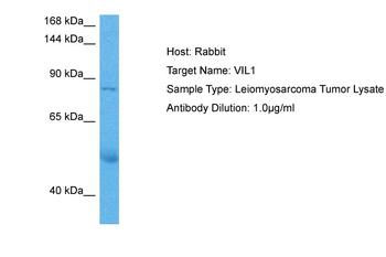 VIL1 Rabbit Polyclonal Antibody