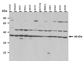 SCD5 Rabbit Polyclonal Antibody