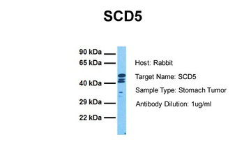 SCD5 Rabbit Polyclonal Antibody