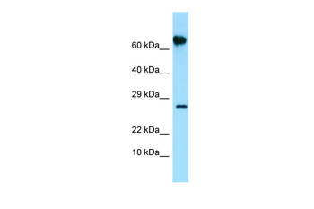 FKBP10 Rabbit Polyclonal Antibody