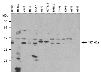 FFAR2 Rabbit Polyclonal Antibody