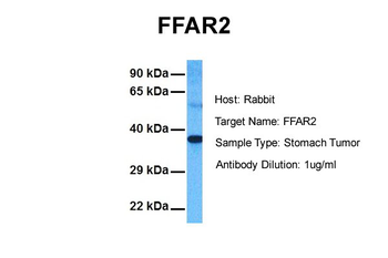 FFAR2 Rabbit Polyclonal Antibody