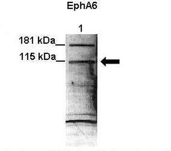 EPHA6 Rabbit Polyclonal Antibody