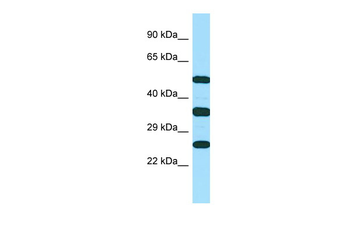 RAET1E Rabbit Polyclonal Antibody