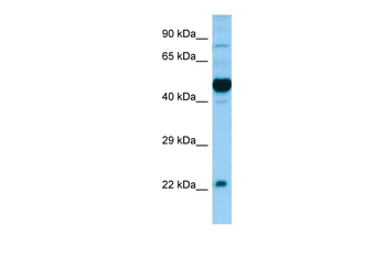 HCRTR1 Rabbit Polyclonal Antibody