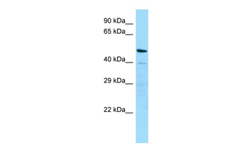 MATN4 Rabbit Polyclonal Antibody