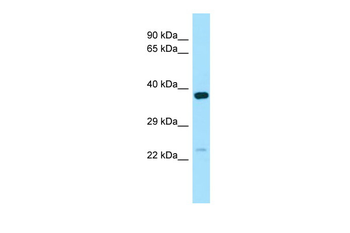 NXNL1 Rabbit Polyclonal Antibody