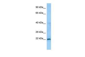 NXNL1 Rabbit Polyclonal Antibody