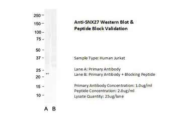 SNX27 Rabbit Polyclonal Antibody