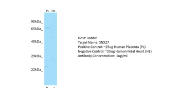 SNX27 Rabbit Polyclonal Antibody