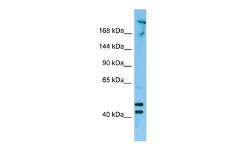 CDC42BPB Rabbit Polyclonal Antibody