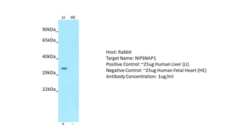 NIPSNAP1 Rabbit Polyclonal Antibody