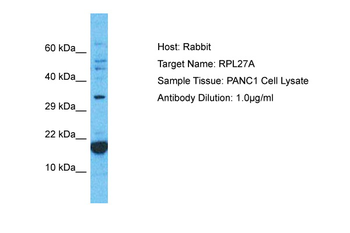 RPL27A Rabbit Polyclonal Antibody