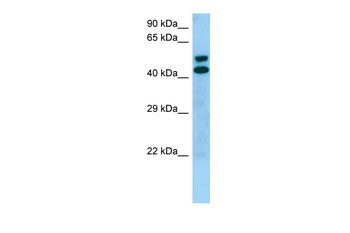 STK19 Rabbit Polyclonal Antibody