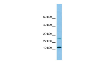 DYNLRB1 Rabbit Polyclonal Antibody