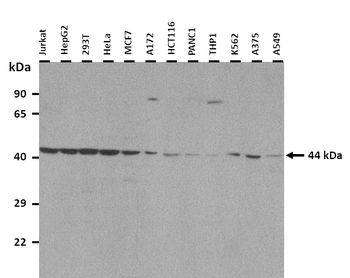 GPR34 Rabbit Polyclonal Antibody