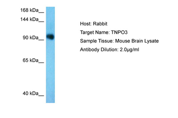 TNPO3 Rabbit Polyclonal Antibody
