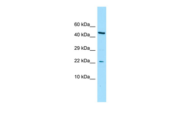 CGGBP1 Rabbit Polyclonal Antibody