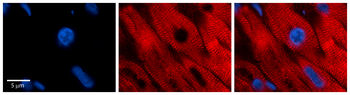 EIF2B2 Rabbit Polyclonal Antibody