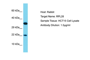 RPL28 Rabbit Polyclonal Antibody