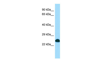 SCNM1 Rabbit Polyclonal Antibody