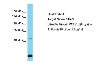 SPAG1 Rabbit Polyclonal Antibody