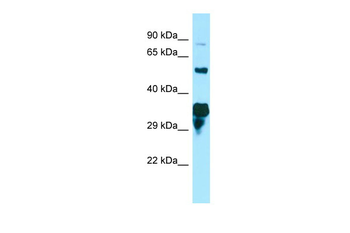 SPG21 Rabbit Polyclonal Antibody
