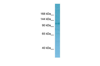 CNKSR2 Rabbit Polyclonal Antibody