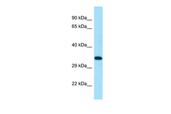 DSN1 Rabbit Polyclonal Antibody