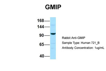 GMIP Rabbit Polyclonal Antibody