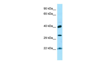 KTI12 Rabbit Polyclonal Antibody