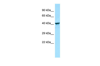 KIR2DL5B Rabbit Polyclonal Antibody