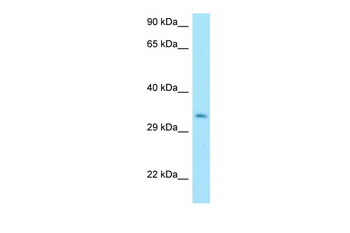 MTX3 Rabbit Polyclonal Antibody