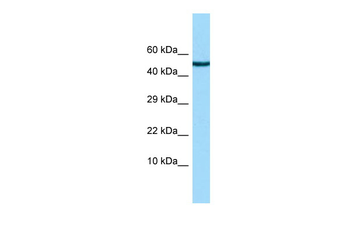 CHRDL2 Rabbit Polyclonal Antibody